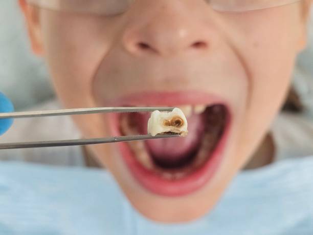 Best Emergency Pediatric Dental Care in West Park, CA